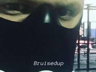 Bruisedup